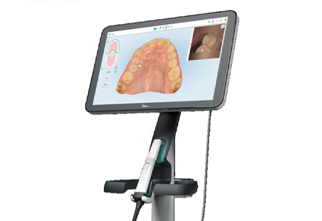 口腔内スキャナー